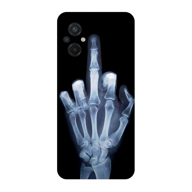 for Poco M5 2022 4G Case Footb - Phone Cases Liverpool ulasan dan harga